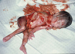late-term abortion 66.jpg